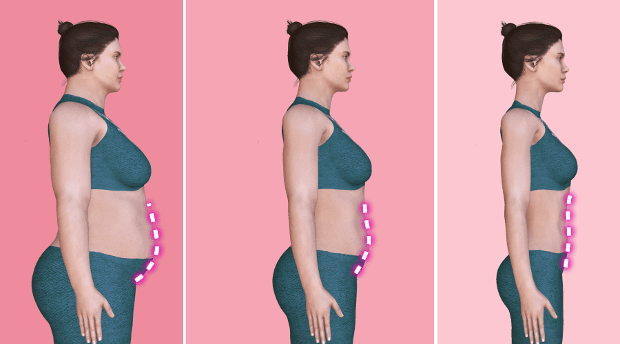 Weight Loss